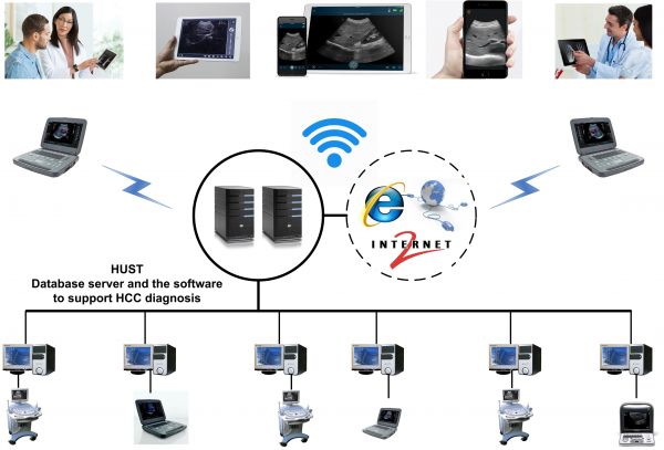 HUST is developing a system that can support the diagnosis of HCC based on big data