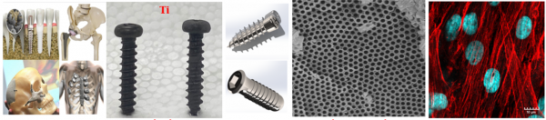 Chi tiết (cấy) ghép y sinh trên cơ sở vật liệu titan phục vụ nhu cầu nội địa hóa